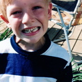 1983 Joe lost a tooth918